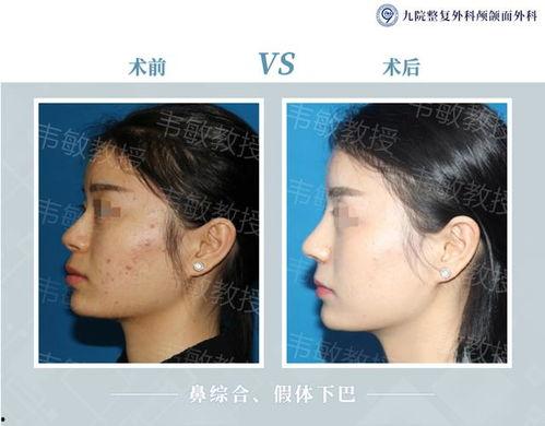 在线国产精品视颏,引领视觉盛宴的影视新潮流